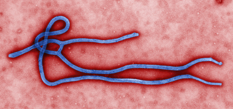 ebola-virus-at-the-microscope