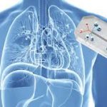 cherry-biotech-organ-on-chipcherrybiotech