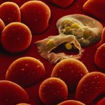 Détection de la malaria à bas coût grâce à la microfluidique featured image