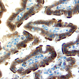 Anhydrase carbonique IX dans le colon d'une souris