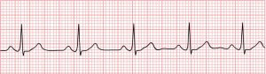 carte-physiologique-cardiac-rythm