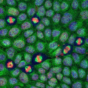 Long long life telomeres aging longevity stem cells