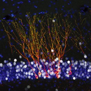 neurones-méthylation-long-long-life