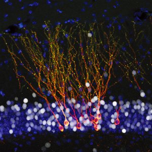 ImageJ=1.44punit=um neurones-méthylation-long-long-life