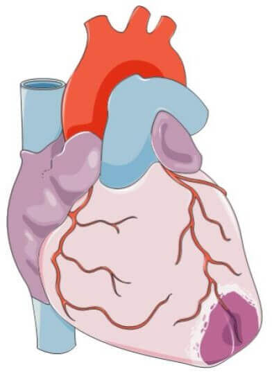 cardiovascular diseases-Long-Long-Life-transhumanism health longevity aging