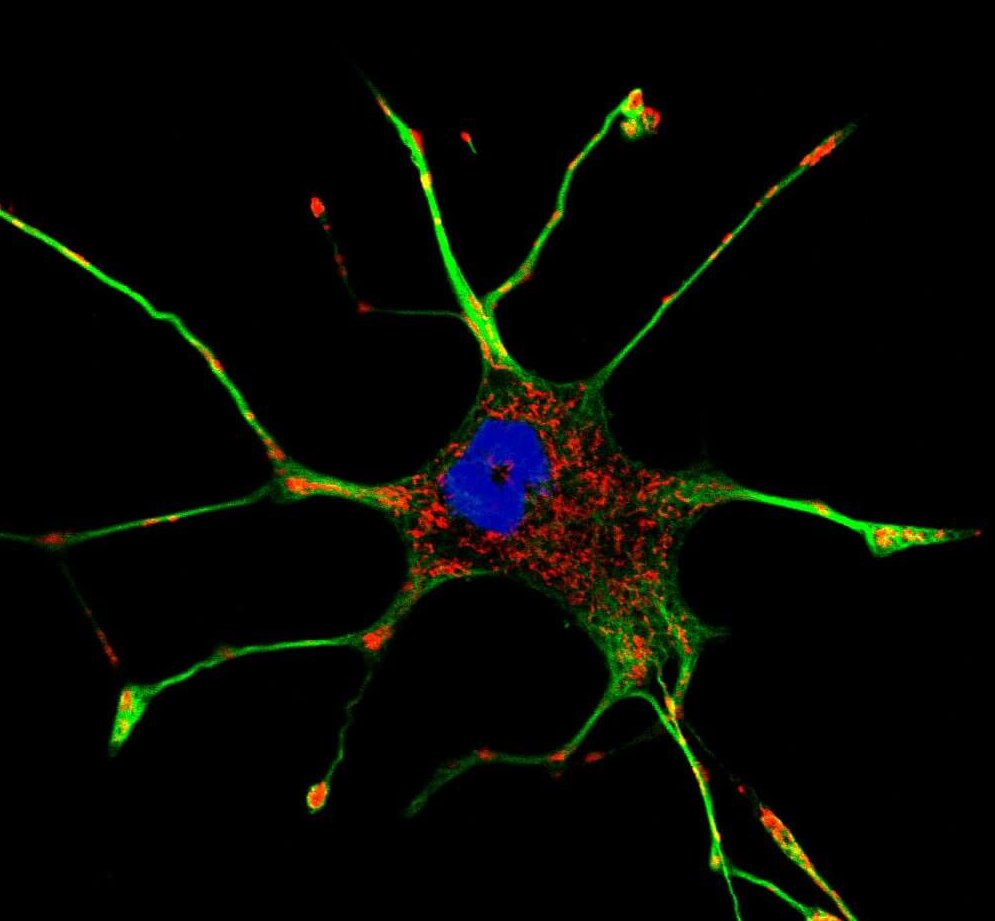 stress cellulaire