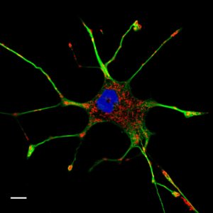 stress cellulaire